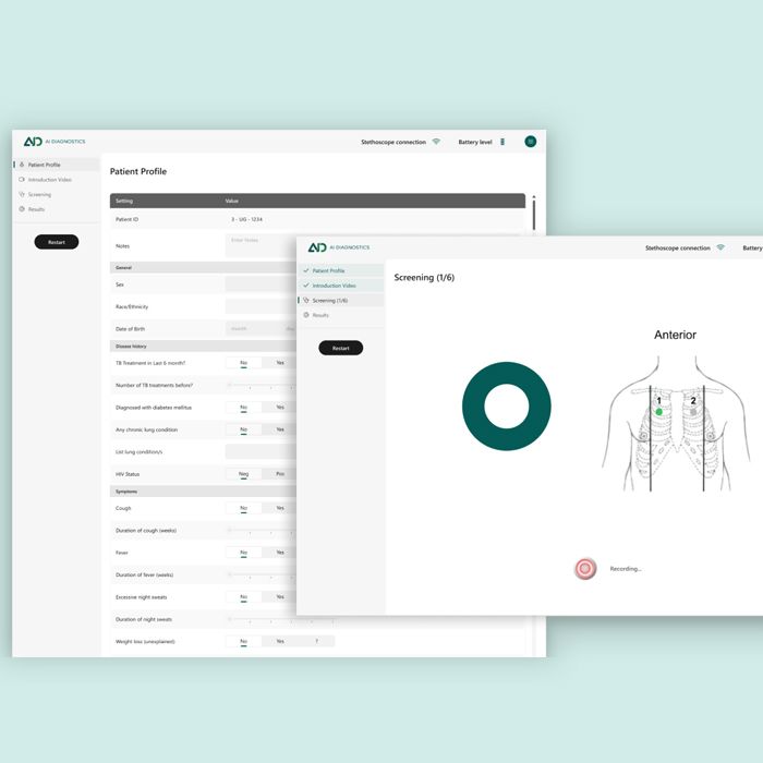 AI For Tuberculosis Diagnostics